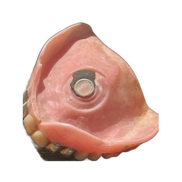 Dentures from Morocco 2016